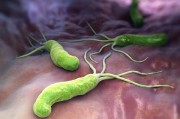 幽门螺旋杆菌的症状有哪些大人幽门螺旋杆菌的症状有哪些