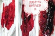 便血的原因,儿童便血的原因