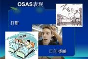呼吸暂停综合症怎么治疗最好的方法,呼吸暂停综合症怎么治疗最好