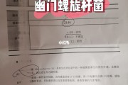 幽门螺旋杆菌阳性是什么病会传染吗幽门螺旋杆菌阳性是什么病