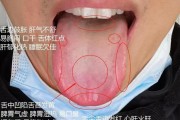 肝阳上亢阴虚内热的症状阴虚内热的症状