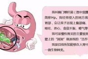 包含筛查幽门螺旋杆菌需要空腹吗的词条