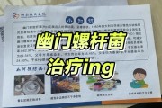 幽门螺旋杆菌最好的治疗方法,幽门螺旋杆菌最好的治疗方法三联药 幽门螺旋杆菌最好的治疗方法,幽门螺旋杆菌最好的治疗方法三联药
