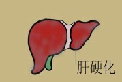 肝脏不好有什么表现症状有哪些女性肝脏不好有什么表现症状有哪些