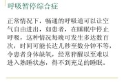 睡眠呼吸暂停综合症射频温控消融治疗术,睡眠呼吸暂停综合症射频温控消融治疗术后流浓时间