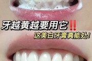 牙垢,牙垢怎么清理
