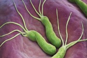 患有幽门螺旋杆菌有什么症状和表现患有幽门螺旋杆菌有什么症状
