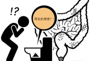 肠癌拉出来大便的图片肠癌拉出来大便的图片 颜色