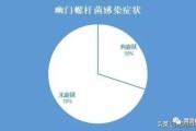 幽门螺杆菌发病症状幽门螺旋杆菌主要症状
