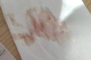 呕吐出血的照片真实,呕吐出血