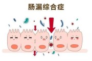 肠痉挛症状痉挛吃什么药效果好
