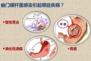 为什么会感染幽门螺旋杆菌阳性为什么会得幽门螺旋杆菌阳性