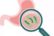 幽门杆菌感染的症状,幽门螺杆菌是什么样的症状