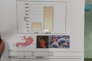 怎样检测幽门螺旋杆菌是否是阳性,幽门螺旋杆菌怎么筛查阳性