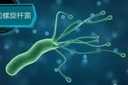 包含幽门螺旋杆菌是什么症状的词条
