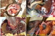 胆胆囊炎的症状是哪里疼