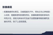 正确认识大肠类癌大肠类癌