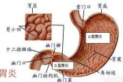 有胃炎的人能否吃南瓜?应该注意哪些实现? 有胃炎的人能否吃南瓜?应该注意哪些实现?