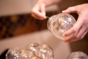 肚子拔罐减肥肚子拔罐减肥位置图