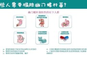 幽门螺杆菌会传染吗,螺旋幽门杆菌会传染给家人吗