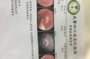 胃镜检查需要多少钱一次,胃镜肠镜检查需要多少钱一次