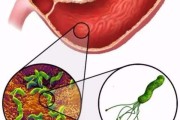 去医院怎么检查幽门螺旋杆菌多少钱去医院怎么检查幽门螺旋杆菌