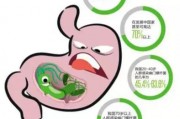 幽门螺旋怎么查幽门螺杆菌怎样检测出来