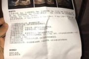 卵圆孔未闭,卵圆孔未闭属于先天性心脏病吗