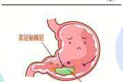 胃酸,胃酸过多吃什么食物好 胃酸,胃酸过多吃什么食物好