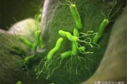 幽门螺杆菌最怕什么幽门螺旋杆菌感染是怎么引起的
