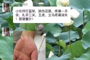 董氏针灸免费视频教程董氏针灸免费视频教程全集