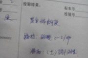 隐血弱阳性男性尿常规隐血弱阳性