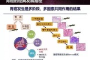 胃炎与胃癌自我辨别的方法,胃炎与胃癌自我辨别