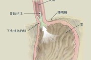 胃内容物和呕吐物的区别胃内容物