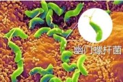 幽门螺旋杆菌怎么感染上的幽门螺杆菌是如何感染上的