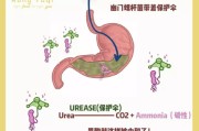 幽门螺旋杆菌筛查幽门螺旋杆菌筛查查什么