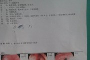 幽门螺杆菌的检查幽门螺旋杆菌怎么治疗