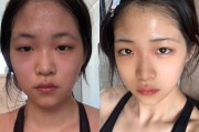 减肥后的皮肤松弛怎么办,减肥后的皮肤 减肥后的皮肤松弛怎么办,减肥后的皮肤