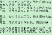 糜烂性胃炎吃什么药效果好,糜烂 糜烂性胃炎吃什么药效果好,糜烂