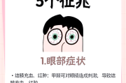房间甲醛高会出现什么症状,房间甲醛高,有什么症状