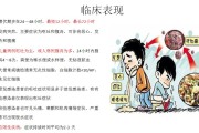 感染性腹泻,感染性腹泻属于哪类传染病