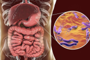 肠胃炎症状表现有哪些肠胃炎症状