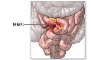 腹痛腹胀腹痛腹胀恶心消化不良