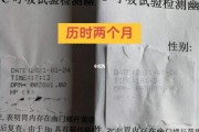 幽门螺旋杆菌怎么检查幽门螺旋杆菌怎么去医院检查