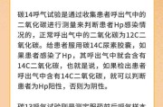 幽门螺旋杆菌的正常值范围碳13幽门螺旋杆菌的正常值范围碳13 332