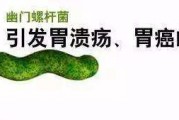 幽门螺杆菌口臭的表现幽门螺旋杆菌表现