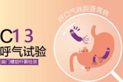 关于胃幽门螺旋杆菌症状有哪些的信息