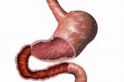 胃溃疡是种什么病？哪些因素会引起胃溃疡呢？