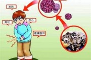 成人上吐下泻吃什么药上吐下泻发烧