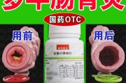 急性肠炎吃什么药,急性肠炎吃什么药